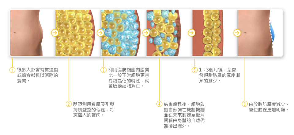 冷凍減脂酷爾塑平(酷塑)的作用過程