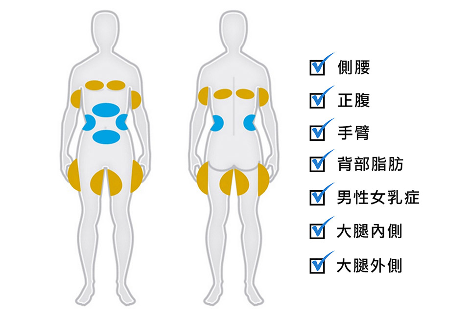 冷凍減脂酷爾塑平(酷塑)的適用對象