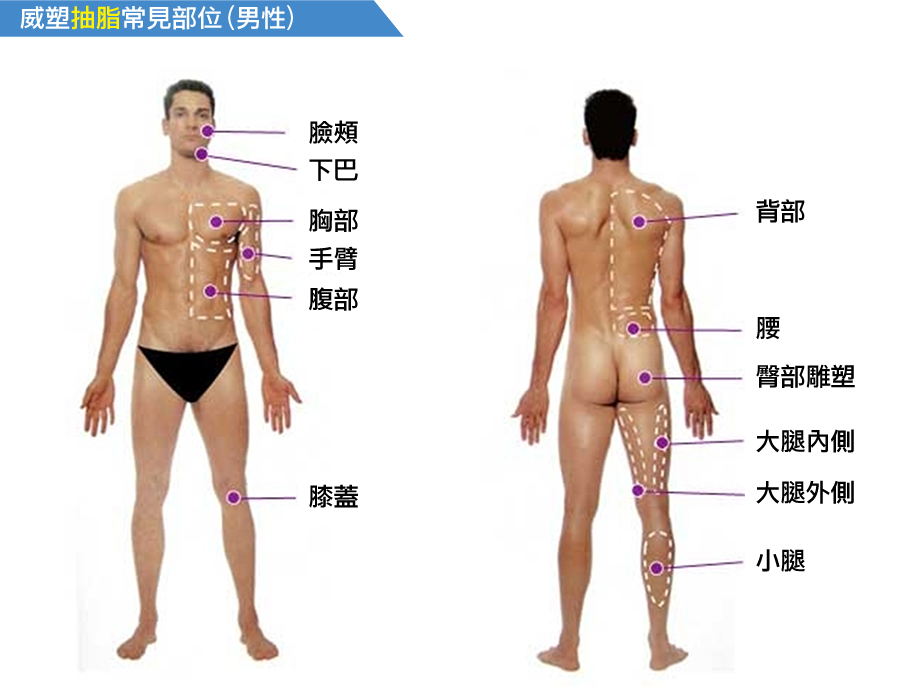 男生抽脂部位