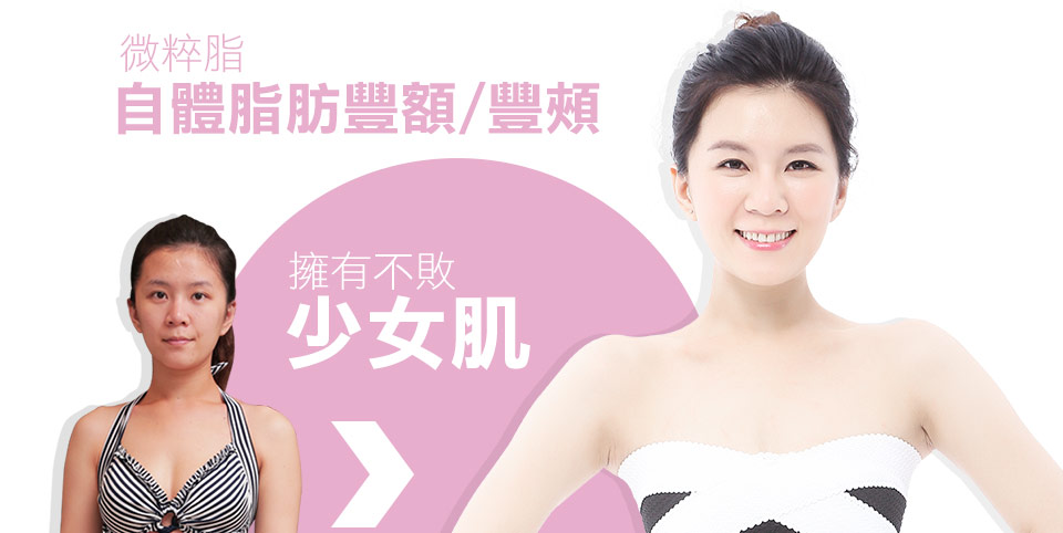 自體脂肪豐頰手術