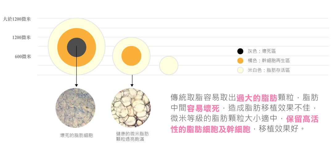 微粹脂自體脂肪補臉優點