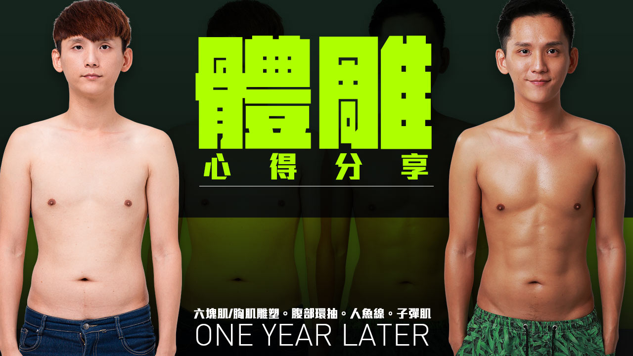 微粹脂+威塑VASER 4D體雕