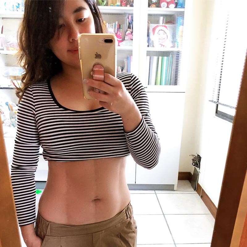 腹部抽脂術後腹部平坦,人魚線顯現-02 腹部抽脂術後腹部平坦,人魚線顯現-02