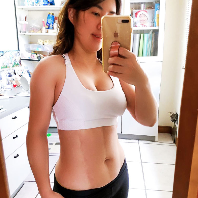 腹部抽脂術後腹部平坦,人魚線顯現-03 腹部抽脂術後腹部平坦,人魚線顯現-03