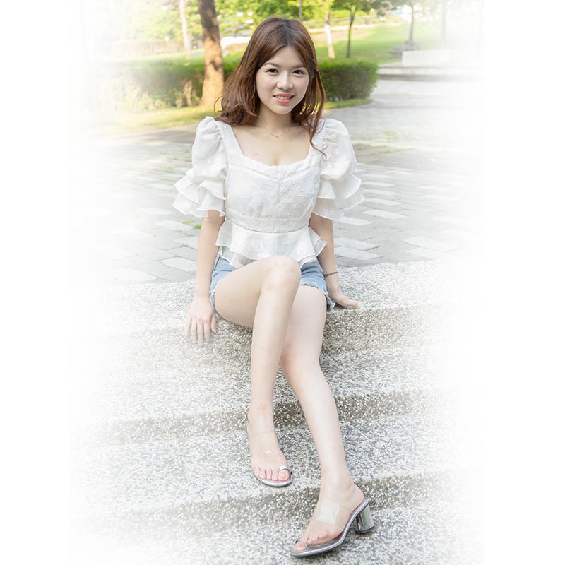 小腿抽脂術後生活照-01 小腿抽脂術後生活照-01