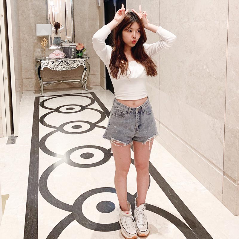 小腿抽脂術後生活照-02 小腿抽脂術後生活照-02