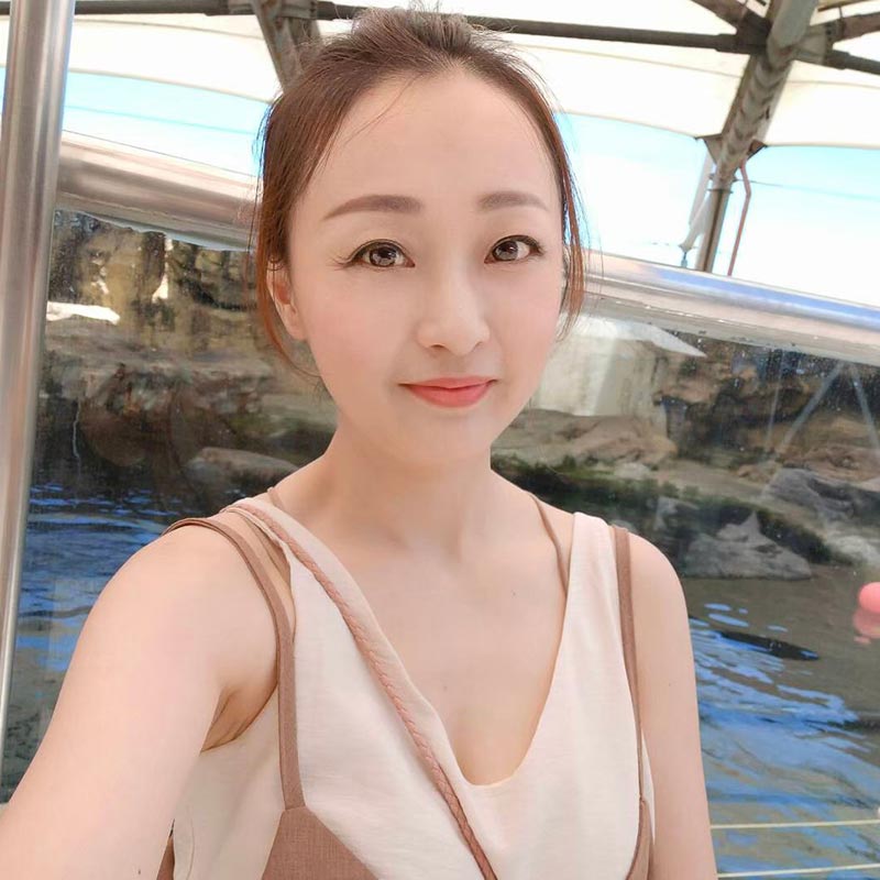 眼袋手術術後生活照-03 眼袋手術術後生活照-03