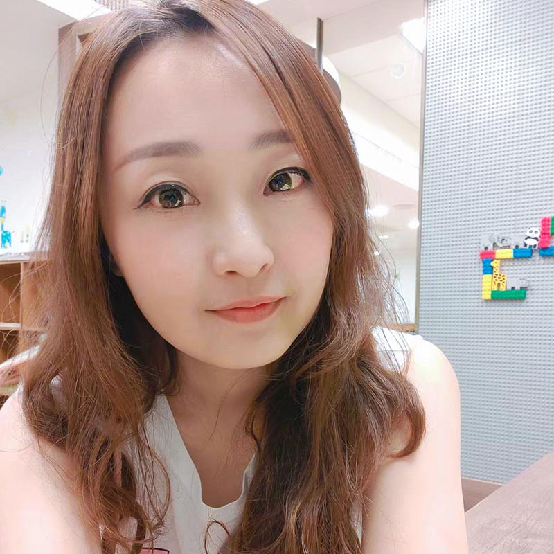 眼袋手術術後生活照-04 眼袋手術術後生活照-04