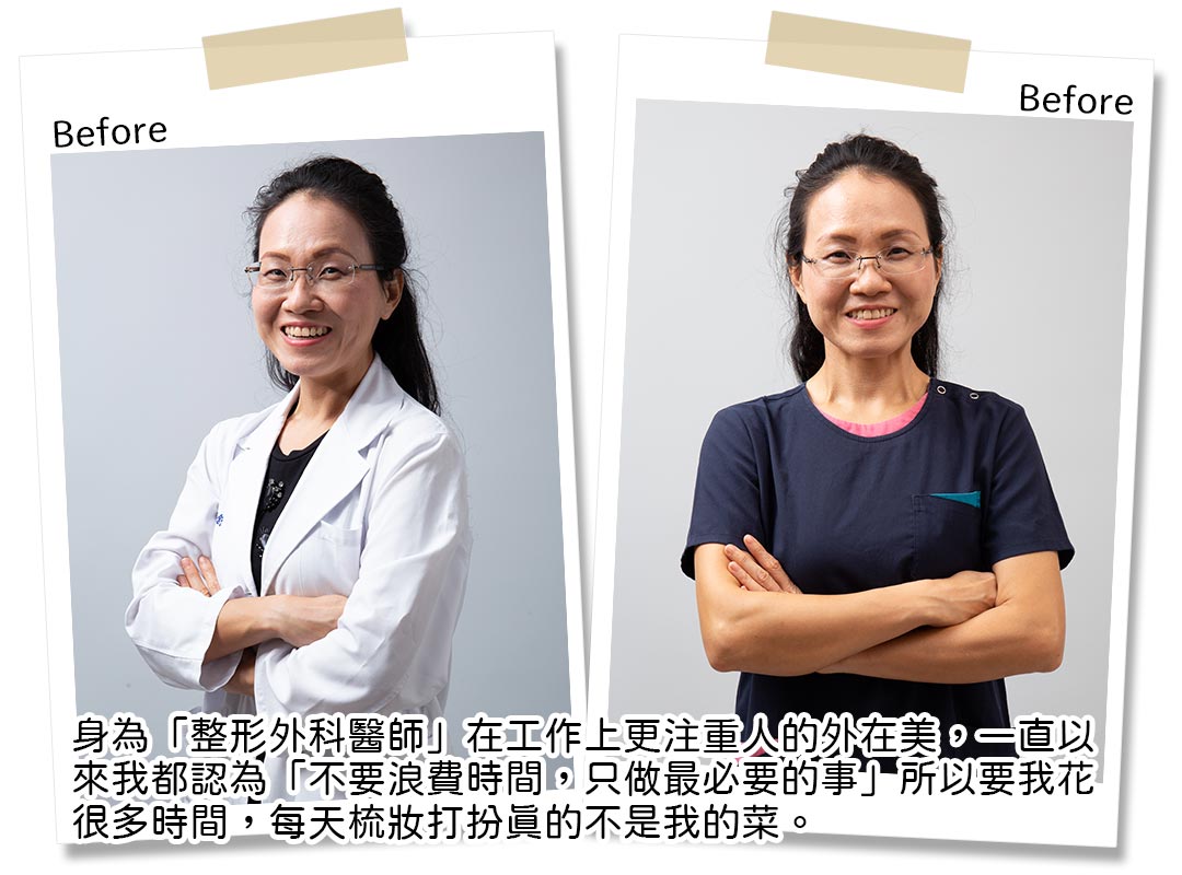 吳曉舒醫師年部年輕化手術術前-pic01 吳曉舒醫師年部年輕化手術術前-pic01