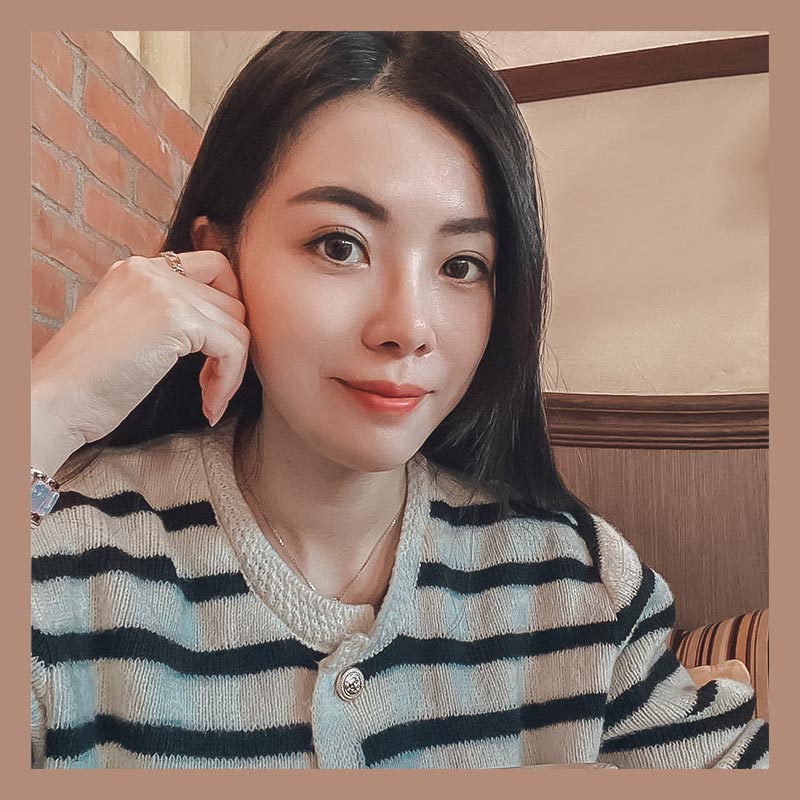 隱痕眼袋手術術後生活照-03 隱痕眼袋手術術後生活照-03