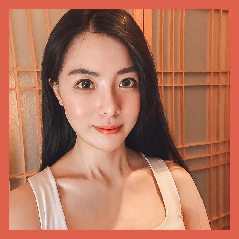 隱痕眼袋手術術後生活照-04 隱痕眼袋手術術後生活照-04