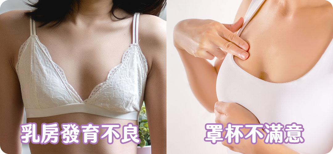 周爾康醫師自體脂肪隆乳隆乳困擾點-01