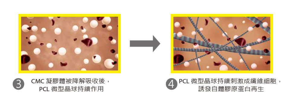 洢蓮絲Ellanse三合一作用機制2