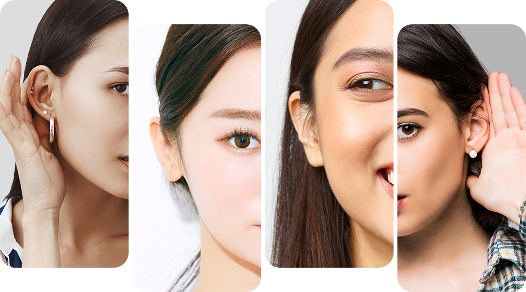 招風耳需要矯正嗎?