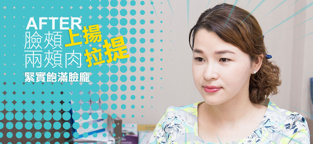 詩立愛立提線術後