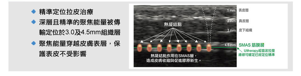 超音波拉提可到達深度