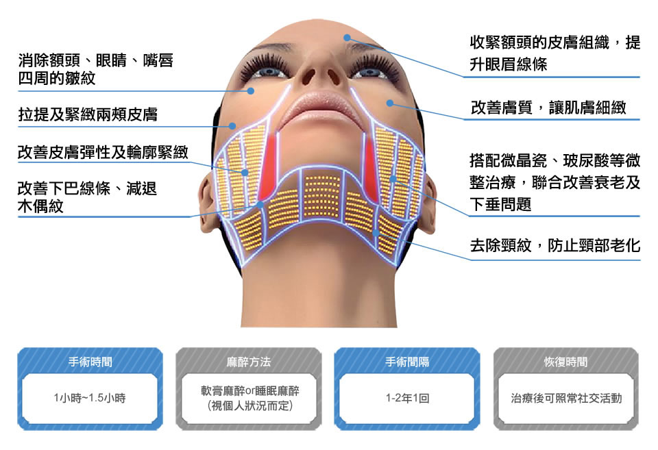 超音波拉提適用部位