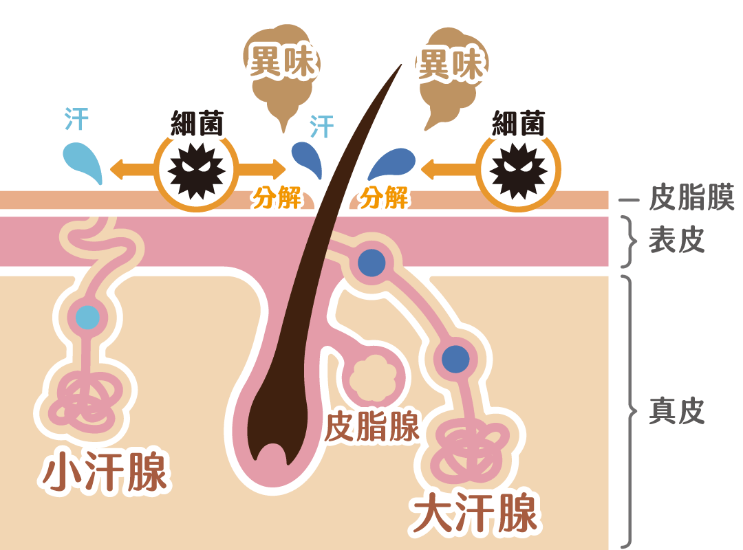 VASER威塑除狐臭手術治療