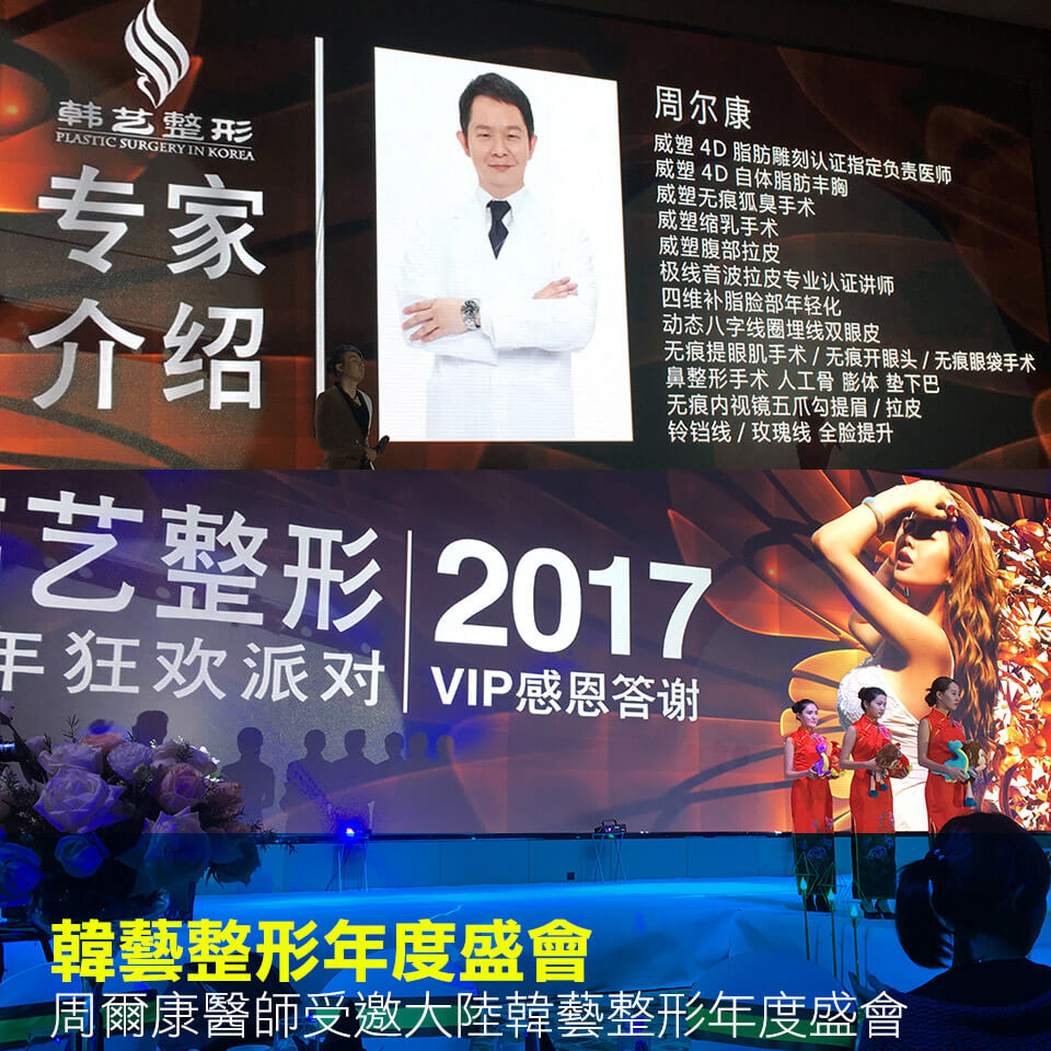 20170113-news-china