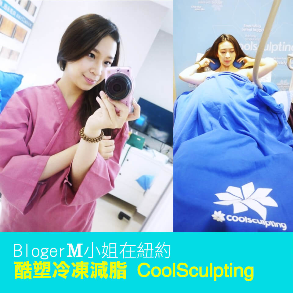 20151010-news-coolsculpting